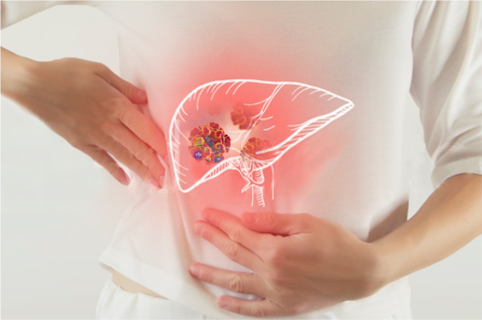 Viêm gan virus - 4 điều cần biết để bảo vệ sức khỏe của bạn 2 Viêm gan virus - Những điều cần biết để bảo vệ sức khỏe của bạn