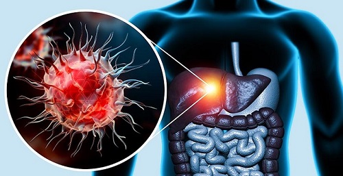 Viêm gan virus - 4 điều cần biết để bảo vệ sức khỏe của bạn 3 Viêm gan virus - Những điều cần biết để bảo vệ sức khỏe của bạn