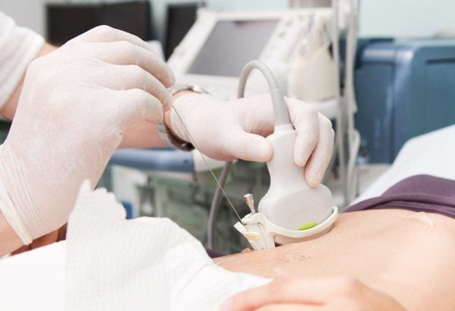 3 điều cần biết: Sinh thiết gan là gì? Có nguy hiểm không? 1 Image
